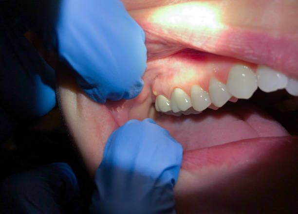 Best Emergency Tooth Extraction  in St Leo, FL